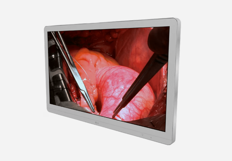 item-Monitor Cirúrgico LG IPS 4K (8MP) 27